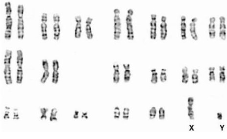 Caryotype du Maine Coon