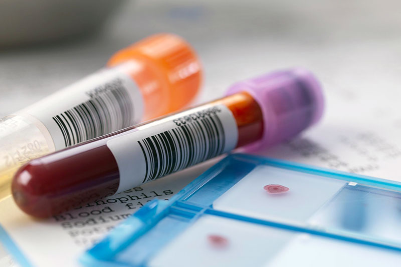 Les groupes sanguins chez les chats