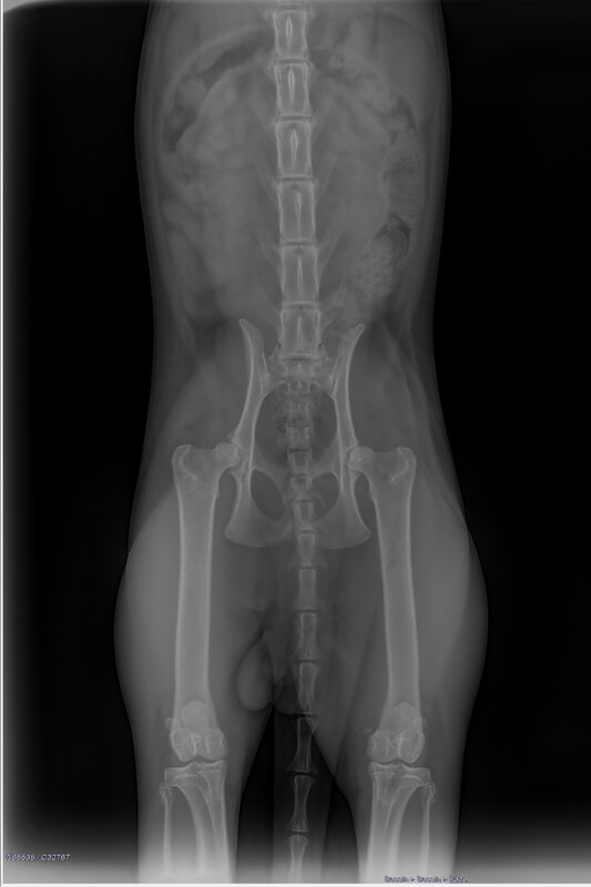 Radiographie dysplasie